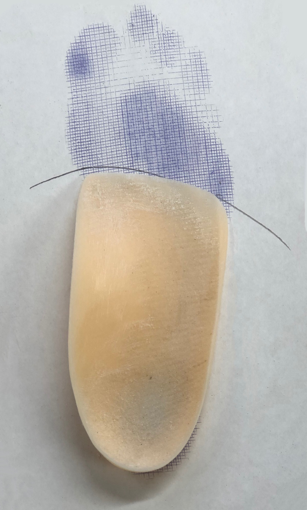 Orthotic Footprint